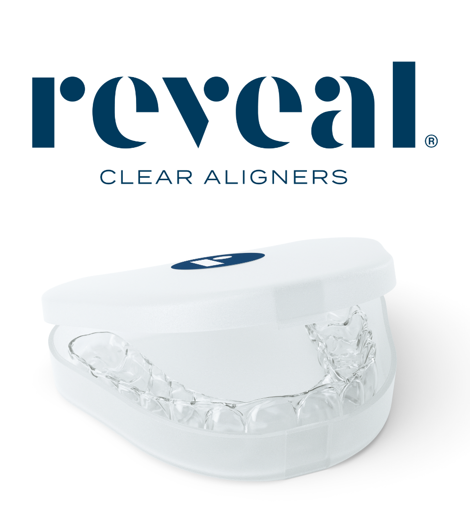 Clear Aligners in Virginia Spencer Dental